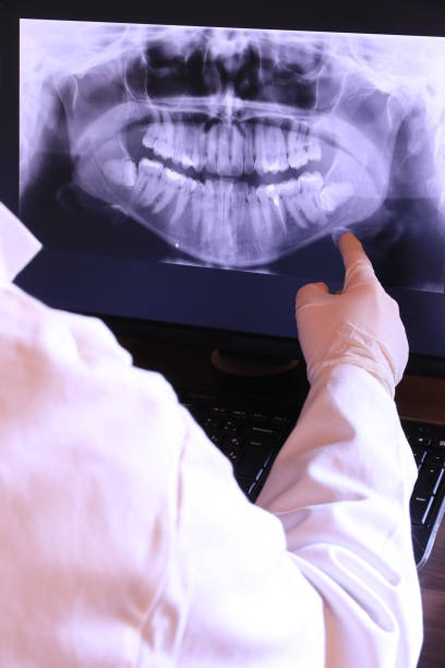 Best Emergency Denture Repair in Steubenville, OH